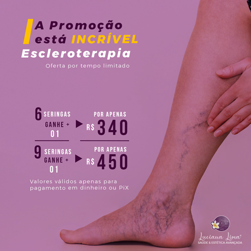 Escleroterapia em Recife