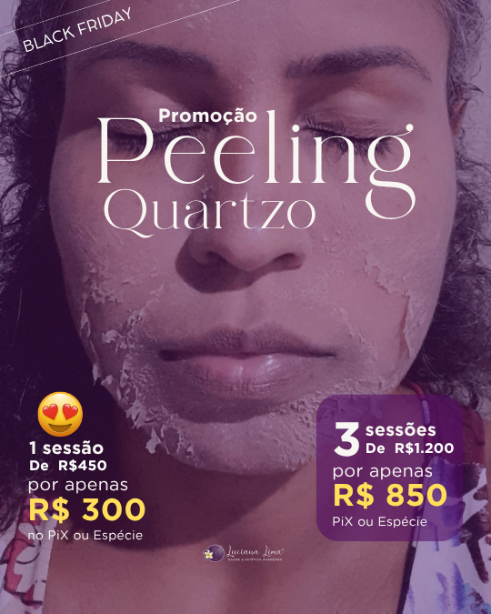 Peeling Quartzo